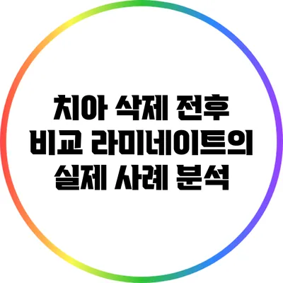 치아 삭제 전후 비교: 라미네이트의 실제 사례 분석
